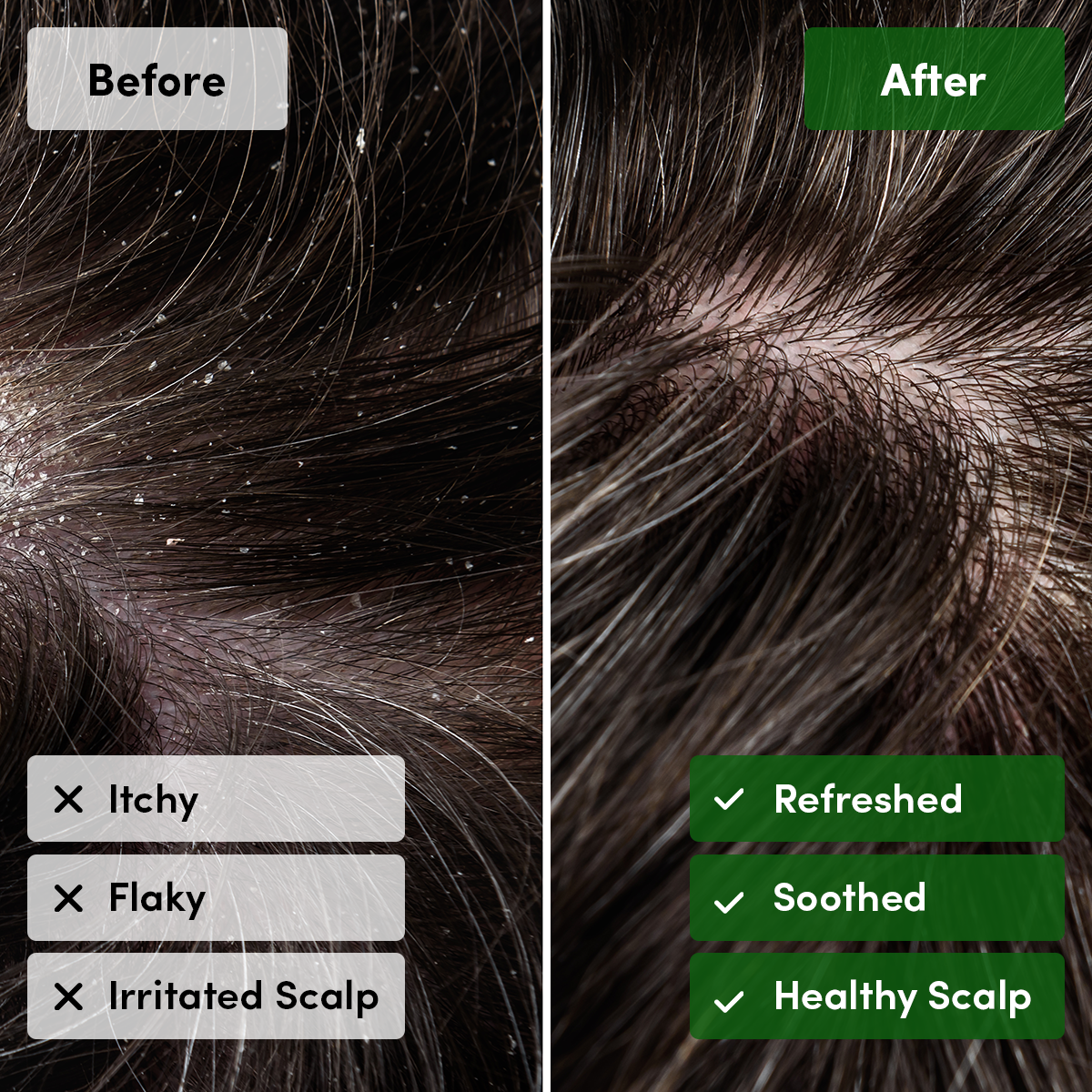 Moringa, Rosemary & Peppermint Shampoo Bar (for Itchy & Flaky Scalp)